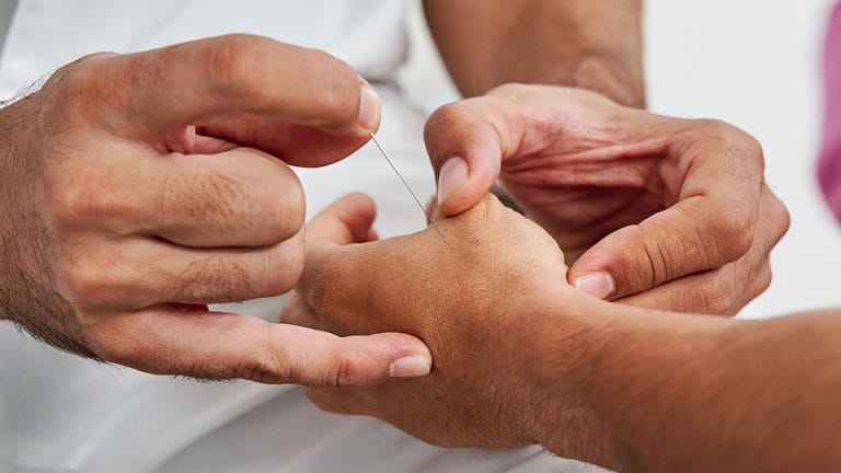 curso de acupuntura tung en malaga