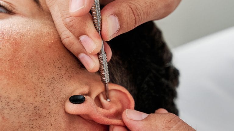 curso auriculoterapia malaga